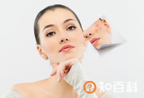 激光去胎记有哪些优点