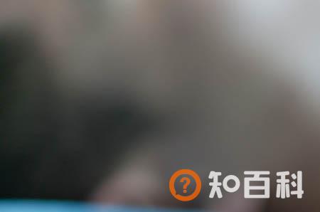 女性阴毛处发痒该怎么办？