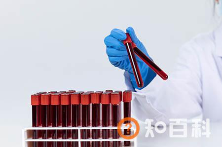 【避孕套用多了会影响怀孕吗】长期用避孕套会导致不孕吗_避孕套用多了会导致不孕吗