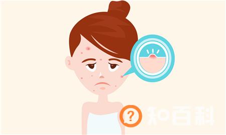 性生活和谐了脸上就不起痘痘了吗