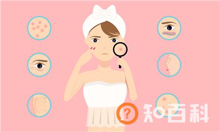 性生活和谐了脸上就不起痘痘了吗