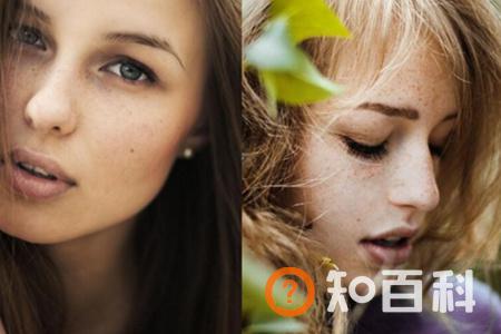 【图】长斑怎么调理  5个方法帮你解决