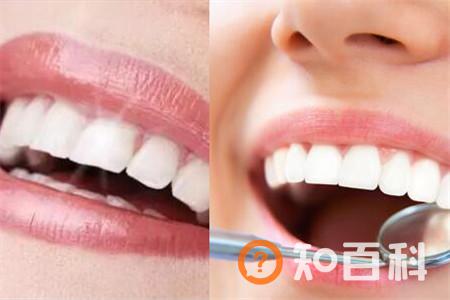 【图】牙根有个洞   到底是哪些原因造成的