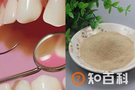 【图】如何清除牙石 简单快捷的小妙招