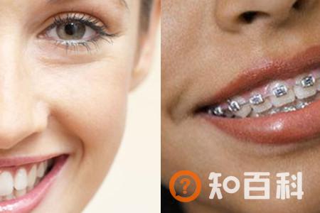 【图】塌鼻龅牙该怎么办  教你如何变美的方法