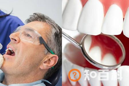 【图】洗牙要多久 根据个人口腔内部情况决定