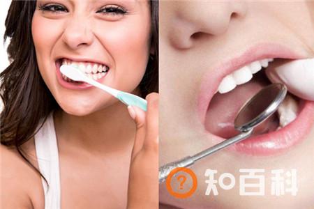 【图】洗牙后的注意事项  保护牙齿的好方法