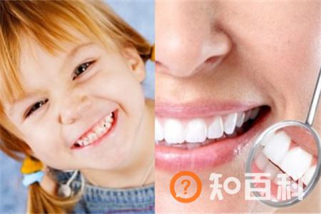 【图】暴牙修复方法介绍  让你拥有美丽牙齿