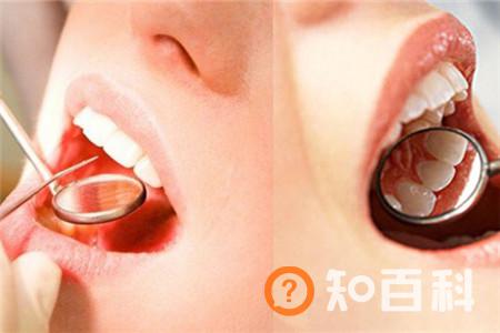 【图】牙根发炎怎么快速消炎 试试这些有效的妙招