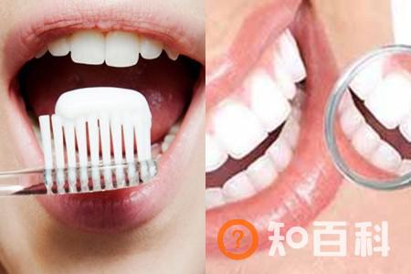 【图】如何进行暴牙修复   技术发达非常容易