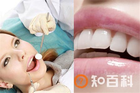 【图】洗牙好不好   可能存在安全隐患