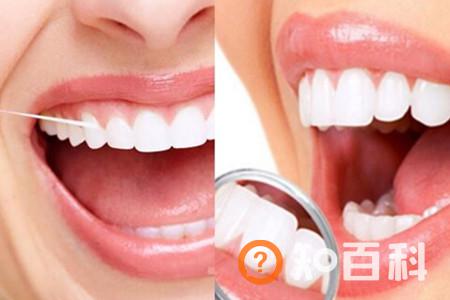 【图】牙线会让牙缝变大吗  这些常识告诉你