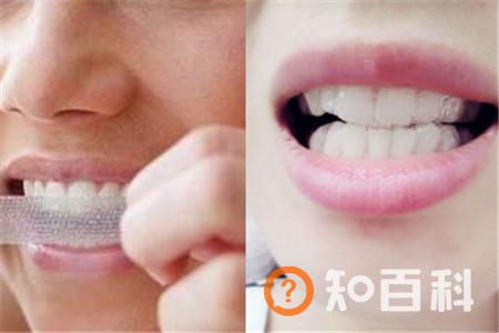 【图】牙齿很黄怎么办    美白牙贴可以起到作用吗