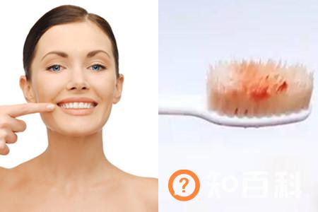 【图】清除牙石牙齿会损坏吗 说说洗牙的好处