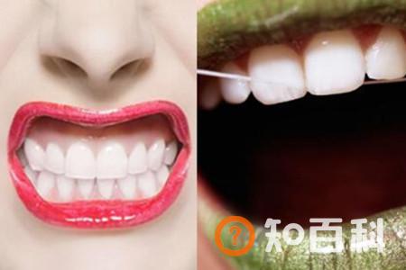 【图】牙线会让牙缝变大吗  这些常识告诉你