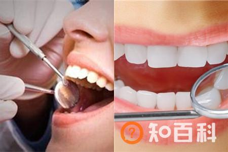 【图】如何进行暴牙修复   技术发达非常容易