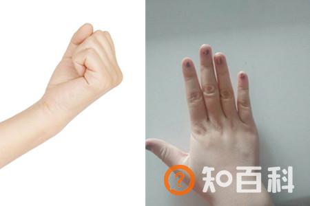 【图】怎么瘦手指才有效 这些动作赶紧学起来